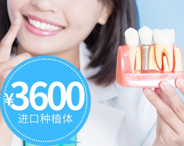 進口種植體3600元